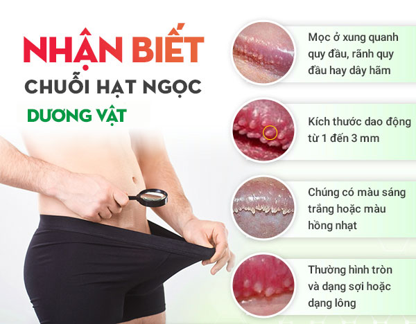 Hạt Ngọc Dương Vật Nhận Biết Sớm