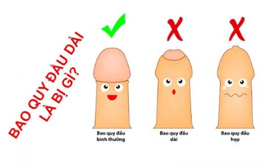 5e841a28d888ad40cf5b82b7_dai-bao-quy-dau-la-gi.jpeg