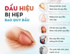 Phương Pháp Điều Trị Hẹp Bao Quy Đầu Hiệu Quả Hiện Nay