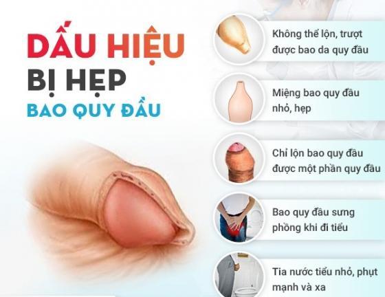 dau-hieu-hep-bao-quy-dau.jpg