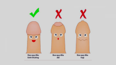 Cách Điều Trị Dài Bao Quy Đầu An Toàn Hiệu Quả Hiện Nay