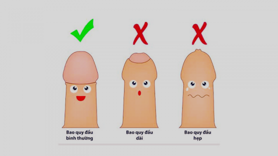 ban-hep-bao-quy-dau.png