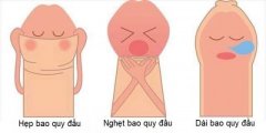 Làm Gì Khi Bị Nghẹt Bao Quy Đầu? Địa Chỉ Chuyên Khoa Hỗ Trợ Điều Trị An Toàn