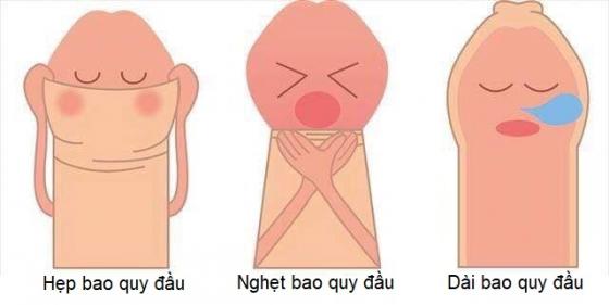 nghet-bao-quy-dau.jpg