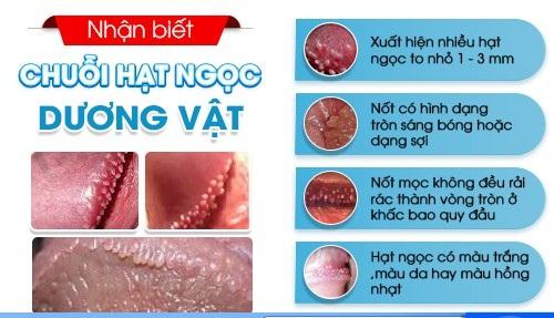 nhan-biet-chuoi-hat-ngoc-duong-vat-53.jpg