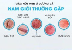 Dương Vật Nổi Đốm Trắng Bao Quy Đầu Cảnh Báo Bệnh Nam Khoa Chớ Nên Xem Nhẹ
