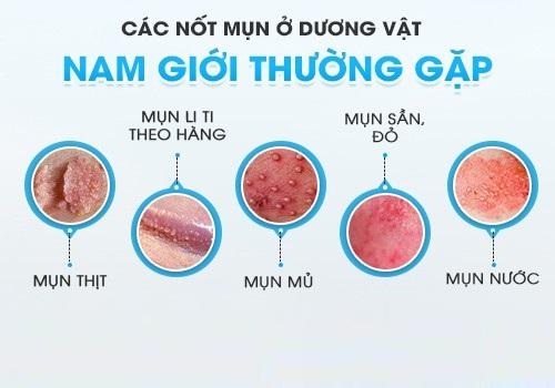 mun-duong-vat-50.jpg