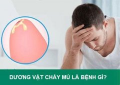 Dương Vật Chảy Mủ Bất Thường, Dấu Hiệu Cảnh Báo Bệnh Nam Khoa Gì?