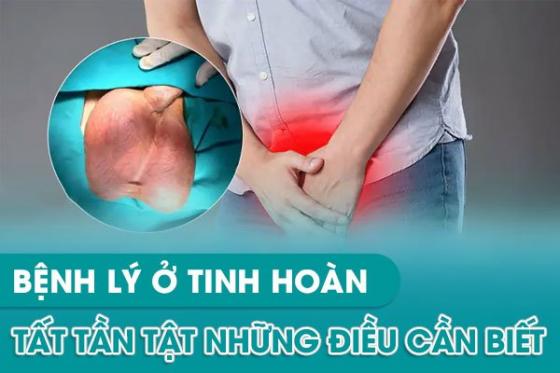 benh-tinh-hoan-0.jpg