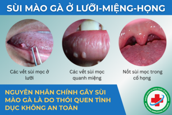 SMG-LUOI.png