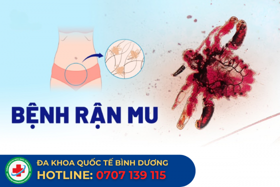 ran-mu.png