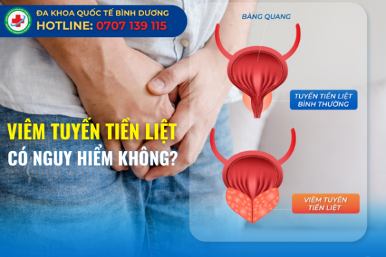 Những Ảnh Hưởng Của Viêm Tuyến Tiền Liệt Và Phương Pháp Điều Trị Hiệu Quả