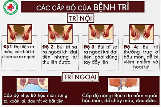 Trĩ (19).png