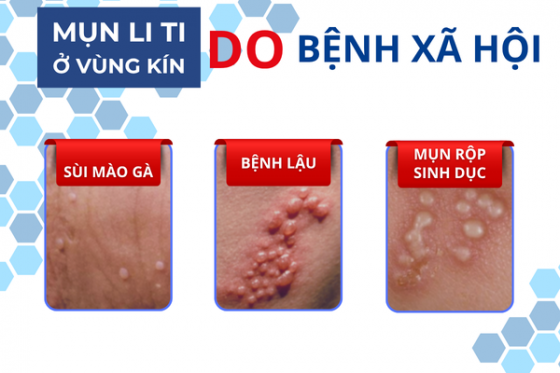 bxh (38).png