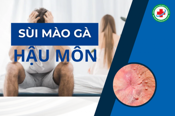 LÒI CỤC THỊT Ở HẬU MÔN LÀ GÌ? CÓ NGUY HẠI GÌ KHÔNG?
