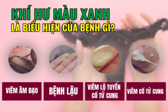Huyết trắng màu xanh: Cảnh báo bệnh gì?