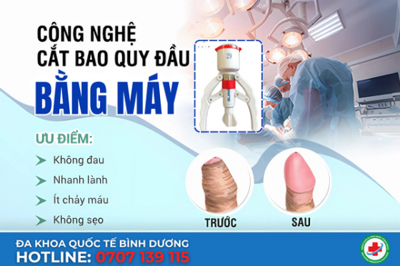 cat-da-quy-dau-bang-may-1.png
