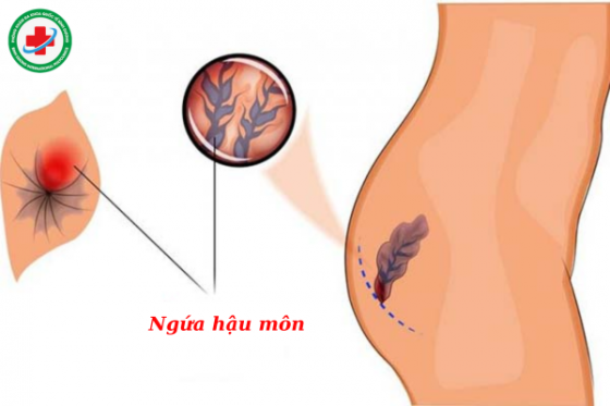 Trĩ (14).png