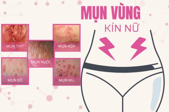 mun-am-dao.jpg