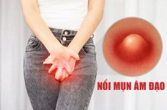 MỌC MỤN ÂM ĐẠO Ở NỮ: NGUYÊN NHÂN VÀ CÁCH ĐIỀU TRỊ