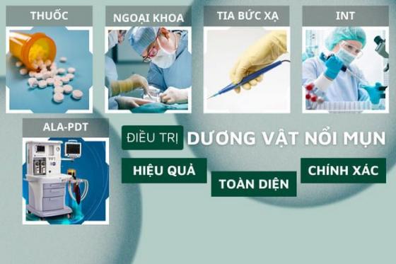 mun-duong-vat-2.jpg