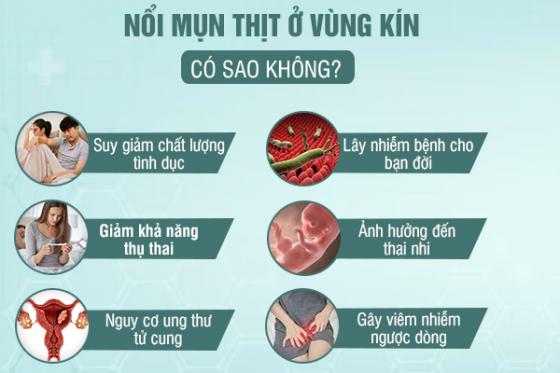 mun-thit-vung-kin-nu-2.jpg