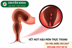 Tổng Quan Tìm Hiểu Các Dấu Hiệu, Biến Chứng Nứt Kẻ Hậu Môn