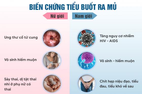 tieu-buot-ra-mu-3.jpg