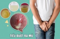 TIỂU BUỐT RA MỦ LÀ BỊ BỆNH GÌ? ĐỊA CHỈ KHÁM CHỮA NGOÀI GIỜ PHÍ KHÔNG ĐỔI