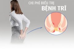 Chi Phí Điều Trị Bệnh Trĩ Bao Nhiêu Bảng Giá Mới Cập Nhật