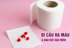 Cảnh Giác: Đi Cầu Ra Máu Và Gây Đau Rát Hậu Môn