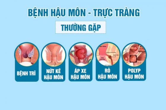 benh-hau-mon-2.jpg