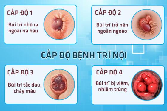 hinh-anh-benh-tri.jpg