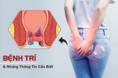 Tổng Quan Bệnh Trĩ: Tìm Hiểu Bệnh Trĩ Nội Trĩ Ngoại Là Gì Và Các Dấu Hiệu Nhậ