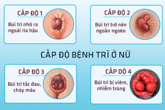 benh-tri-o-nu-1.jpg