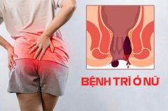 Bệnh Trĩ Ở Nữ Giới. Dấu Hiệu Nhận Biết Và Cách Điều Trị