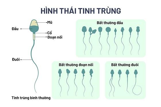 hinh-thai-cua-tinh-trung (1).jpg